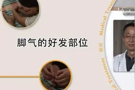 脚背上长的癣是脚气吗？脚气大多发生在什么部位？听听医生怎么说