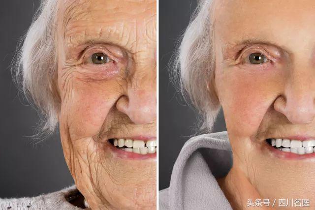 鍙樼櫧锛佺槮鑴革紒杩欎簺鍦ㄨ劯涓婃墦鐨勯拡锛岀湡鏈夐偅涔堢濂囷紵