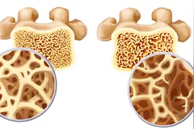 喝可乐的5大危害，伤胃致肥胖，尤其第五个要注意！