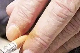教你一招，轻松洗掉抽烟造成的指甲变黄，只用这个就可轻松去除！视频封面