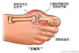 全了！各年龄段血压、血糖、血脂、尿酸对照表，快告诉家人图片