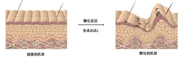 抗糖就是为了好肌肤放弃吃糖？我们告诉正确的吃糖法！