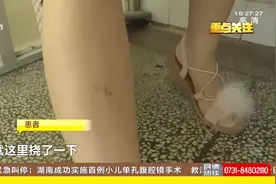 夏季为动物咬伤高发季 狂犬病潜伏期为1到3个月 患者应及时就医视频封面