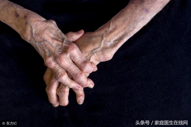 黑色丘疹青年脂溢性角化病