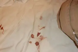 去除床垫上的血迹，教你一个小妙招，快速去除不留痕迹，快试试吧视频封面