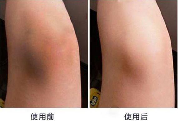 vc能溶解在哪些身体乳里