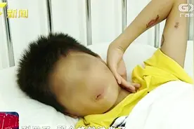 南宁：3名小孩摘龙眼遭马蜂袭击 一死两伤视频封面