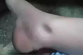 身体好不好，看脚就知道！脚肿竟可能是大病征兆！图片