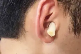 睡前把大蒜放入耳朵里，这个作用太神奇了，可惜好多人都不知道视频封面