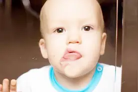 “马牙”医学名“上皮珠”，孩子长这种牙时，处理不当是在害孩子