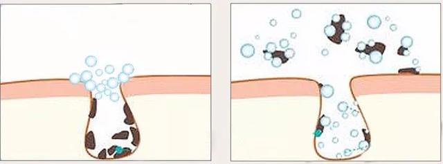 用它洗脸=敷面膜，素颜皮肤都好到惊人