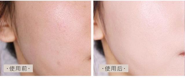 用它洗脸=敷面膜，素颜皮肤都好到惊人