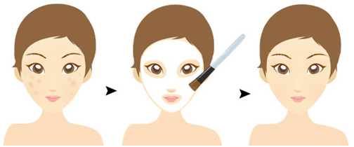 果酸治疗毛周角化症刷酸要慎重