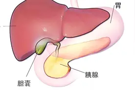 胆囊切除手术3D全过程，胆囊炎，胆结石