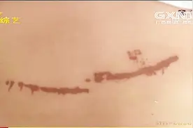 女孩吃“冒烟冰淇淋”被零下196度液氮冻伤，医生说永远好不了视频封面