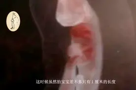 这个孕周胎宝初具人形，还带着“小尾巴”, 看起来就像一只小蝌蚪视频封面
