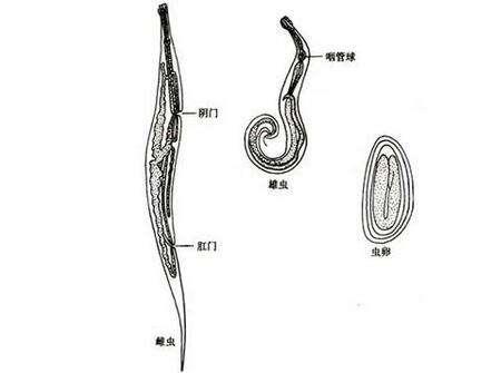 儿童肛门有虫子怎么办