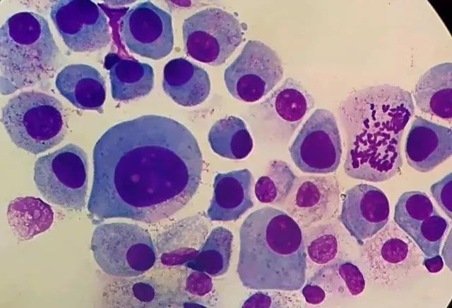 街坊说的那些“术后忌口”，到底该不该信？