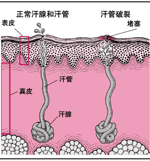 璐濅翰妗冨瓙姘ㄥ熀閰告礂鍙戞矏娴翠簩鍚堜竴锛岄闃叉秷闄ょ棻瀛愬ソ甯墜
