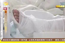 一根牙签惹的祸！男子左脚底被牙签刺伤 竟致脚趾坏死被切除