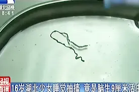毛骨悚然！16岁少女睡觉抽搐，竟发现9厘米的活虫脑里钻来钻去视频封面