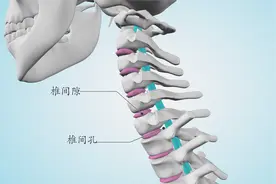 得了颈椎病不枕枕头可能加重病情 专家说用这种枕头可以延缓病情