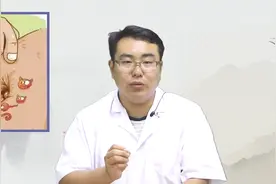 肚脐眼中的污泥能不能抠？操作不当易感染！如何清洗？教你一招！视频封面