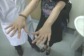 警惕！年轻女性言语不清走路不稳 原来是“美女病”反复发作视频封面