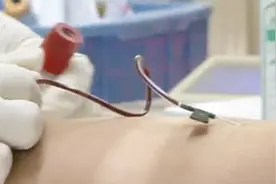 血检时这一指标能看出肾功能和营养水平状况 看看你正常吗？