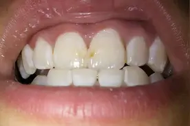 刷牙的时候，水里加点它，刷完干净洁白真好用，我赶紧去试了视频封面