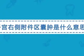 子宫右侧附件区囊肿是怎么回事？医生说可能是这两种情况视频封面
