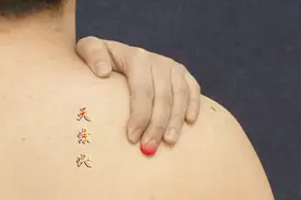 上班族患上颈肩综合征如何缓解好？中医说按摩这一穴位有良效视频封面