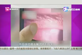 琪琪看医疗：飞虫入眼怎么办？琪琪看医疗：飞虫入眼怎么办？
