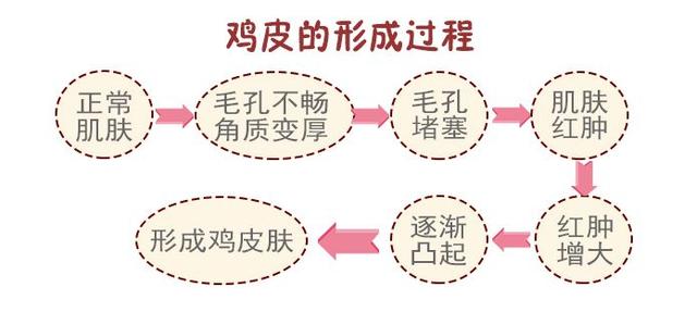 维e乳对买粥角化有作用吗