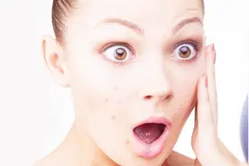 脸上长痘不要怕，每天这样按摩2分钟，痘痘一扫而光视频封面