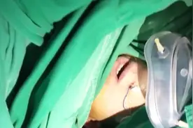 手术室里传出歌声 一边开颅一边唱歌视频封面