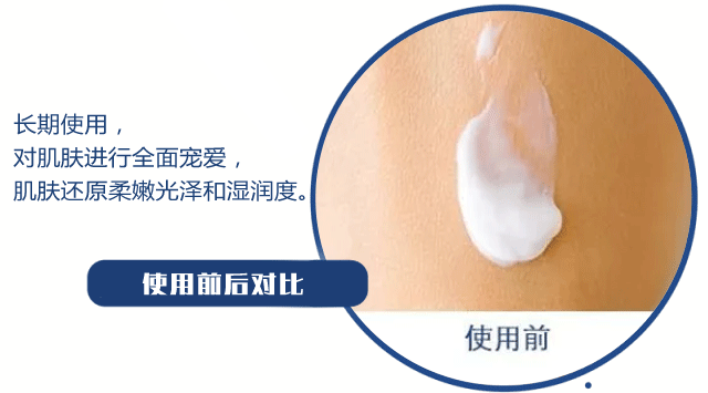 多芬身体乳秋冬干皮