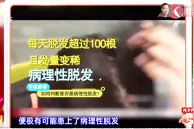 头发一掉一大把？你可能出了这个问题！脱发严重是如何导致的？