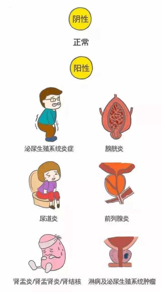 科普｜体检报告单那些名词儿看不懂？那就用这些漫画来搞明白它！