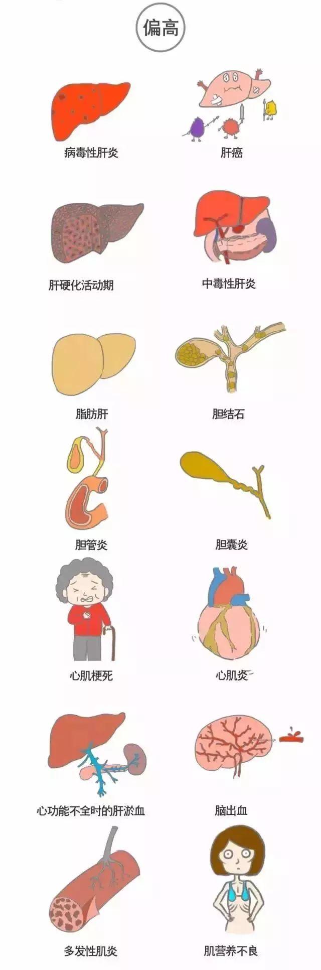 科普｜体检报告单那些名词儿看不懂？那就用这些漫画来搞明白它！