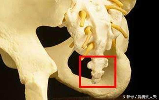尾骨很疼怎么办