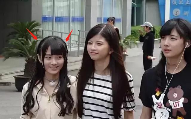 耳朵前鬓角下鸡皮疙瘩红印 耳朵前鬓角下鸡皮疙瘩红印