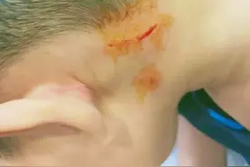 心累，孩子又在幼儿园打架了，聪明的父母都这样做图片