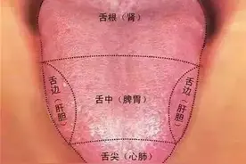 看舌诊病！学会这几招，你也是专家图片