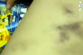 上海一9岁男孩练击剑遭教练抽打！是否惩戒过度？网友热议，我们请来了专家图片