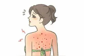 后背爆痘太闹心，这样做，让你无惧露背装图片