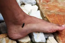 水蛭如果被人不小心吃进肚子里，它在人的肚子里还可以活吗？图片