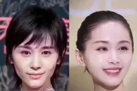 王子文全脸填充变甜美，但你是否提前做好了整容风险的心理准备？图片