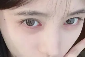 看“眼睛”认明星，鞠婧祎眼角痣很明显，全部认出是“饭圈大佬”图片