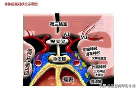 头颅磁共振（MRI）解剖--精品图集图片